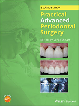 Practical Advanced Periodontal Surgery Second Edition cover for ISBN 9781119196310