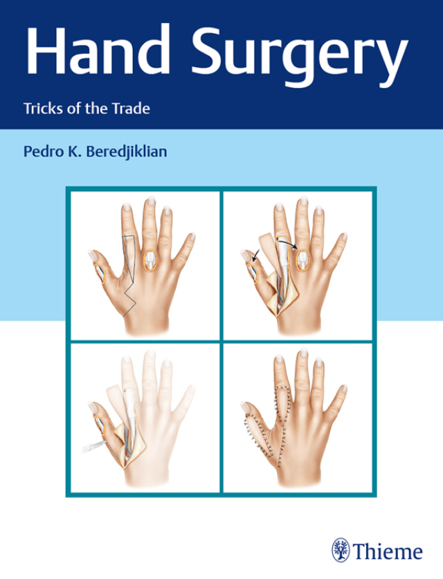 Hand Surgery cover for ISBN 9781626234796