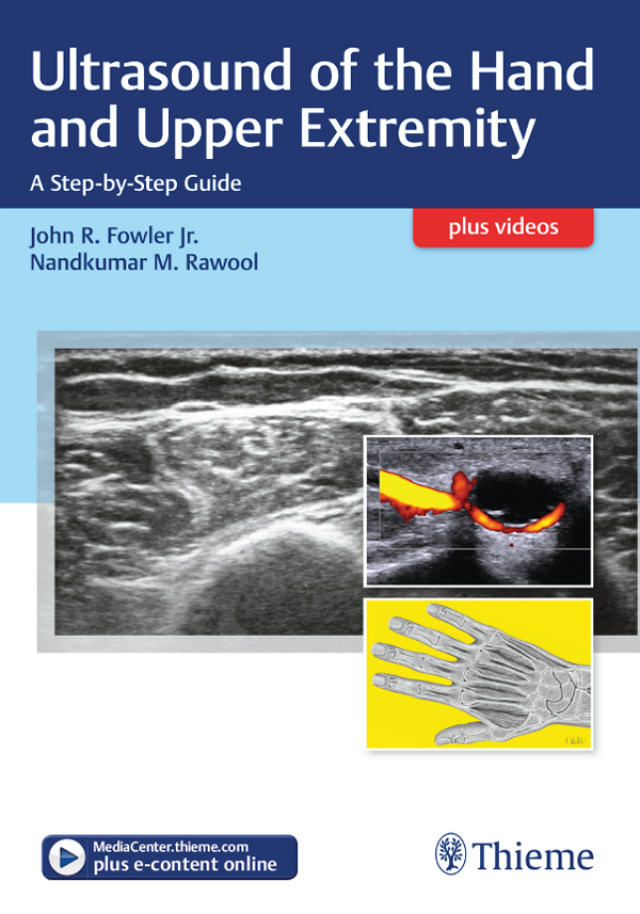 Ultrasound of the Hand and Upper Extremity cover for ISBN 9781626236882